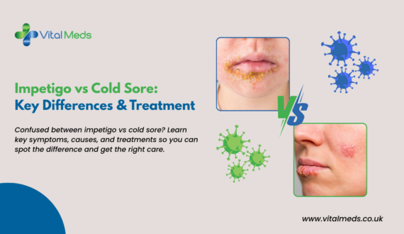 Impetigo vs Cold Sore: Key Differences & Treatment